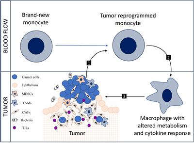 Commentary: PFKFB3 overexpression in monocytes of patients with colon but not rectal cancer programs pro-tumor macrophages and is indicative for higher risk of tumor relapse